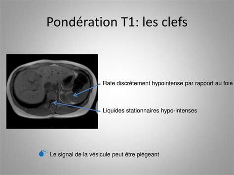 exercices de td 2am|IRM HÉPATIQUE LES SÉQUENCES INDISPENSABLES.